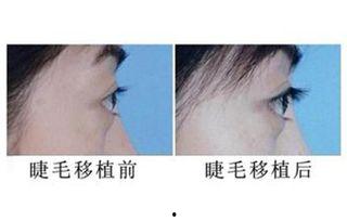 明星种植睫毛图片欣赏,惊艳蜕变揭秘